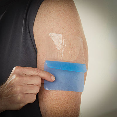 هیدروژل زخم